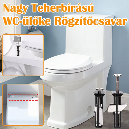 🚽 WC-ülőke rögzítő csavar szett – Erős, megbízható, könnyen felszerelhető 🔥